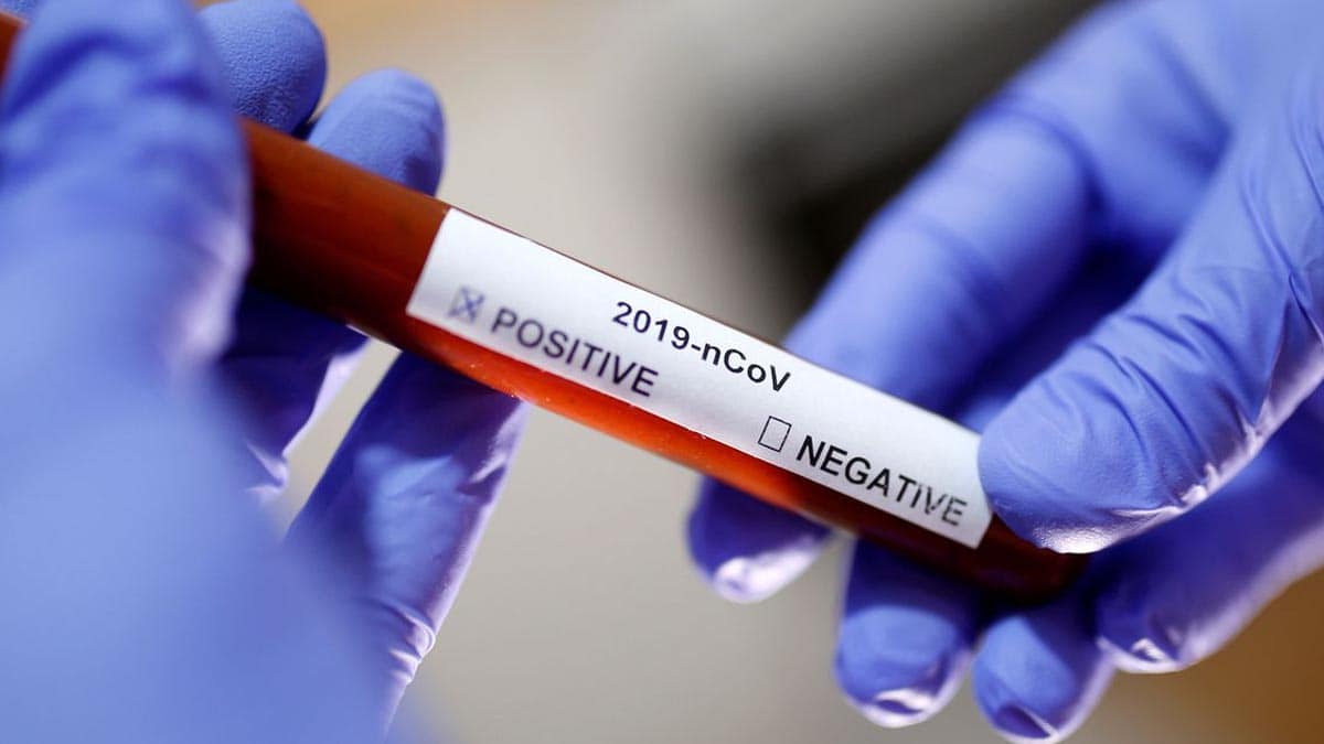 Gestante e marido testam positivo para Covid-19 em Corumbá