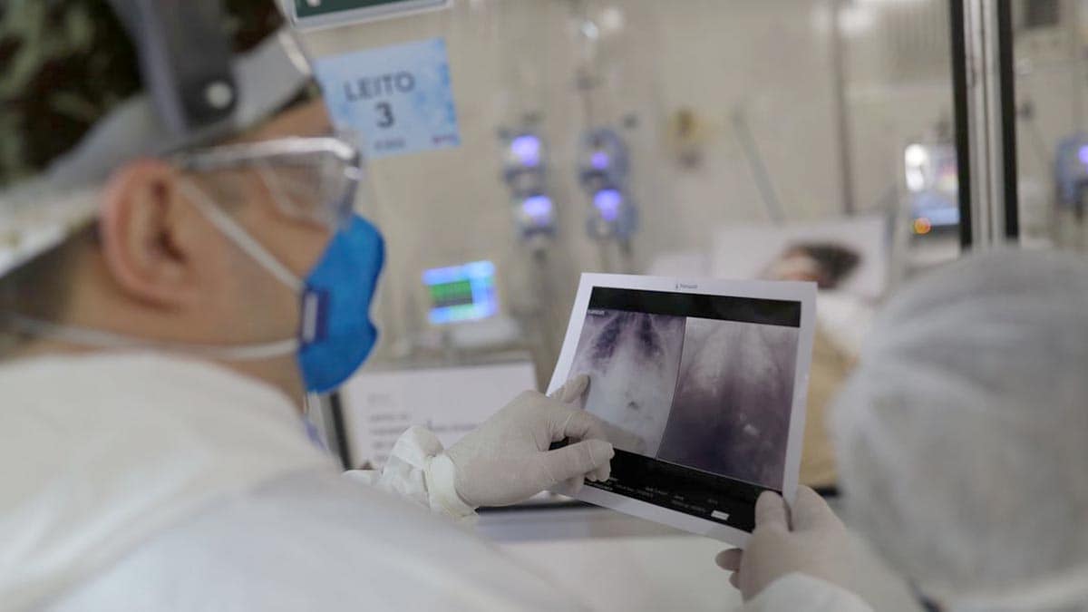 Covid faz mais 13 vítimas fatais em Mato Grosso do Sul