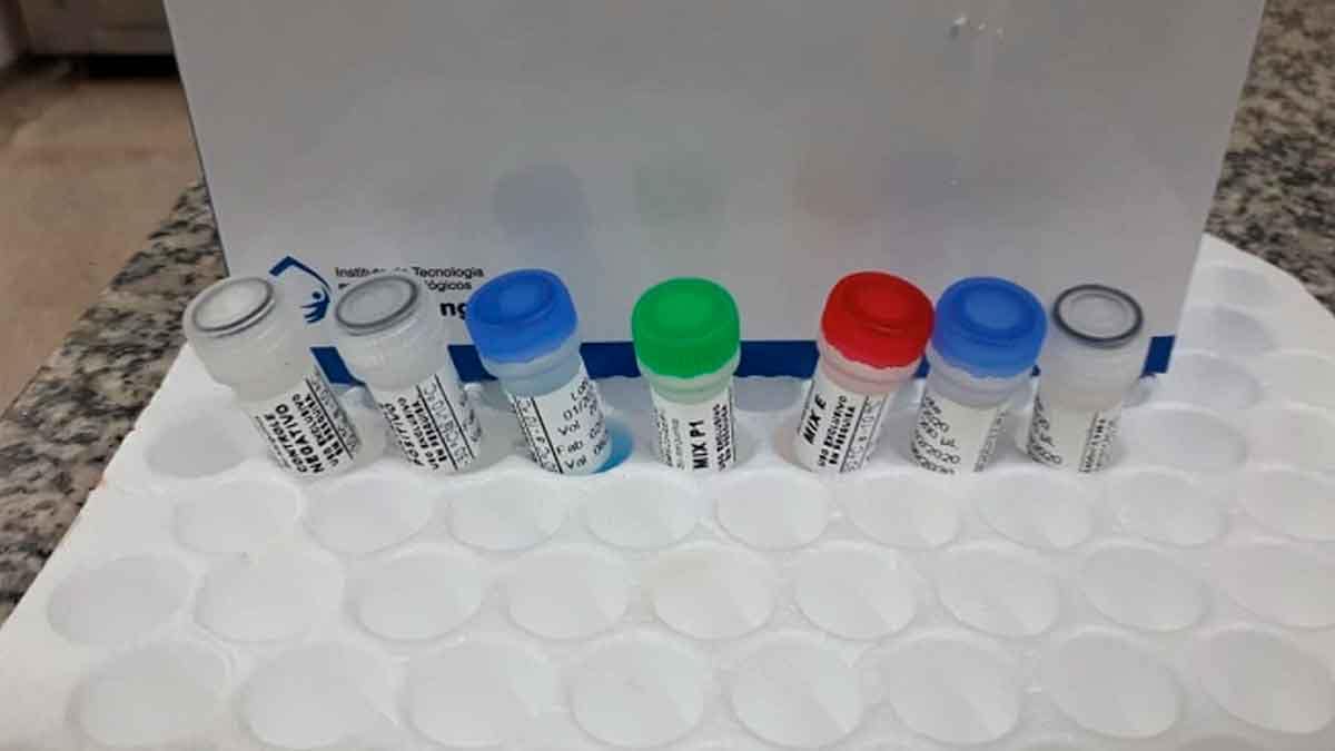 Prefeitura vai fazer 242 testes em servidores que atuam na linha de frente contra o Covid-19