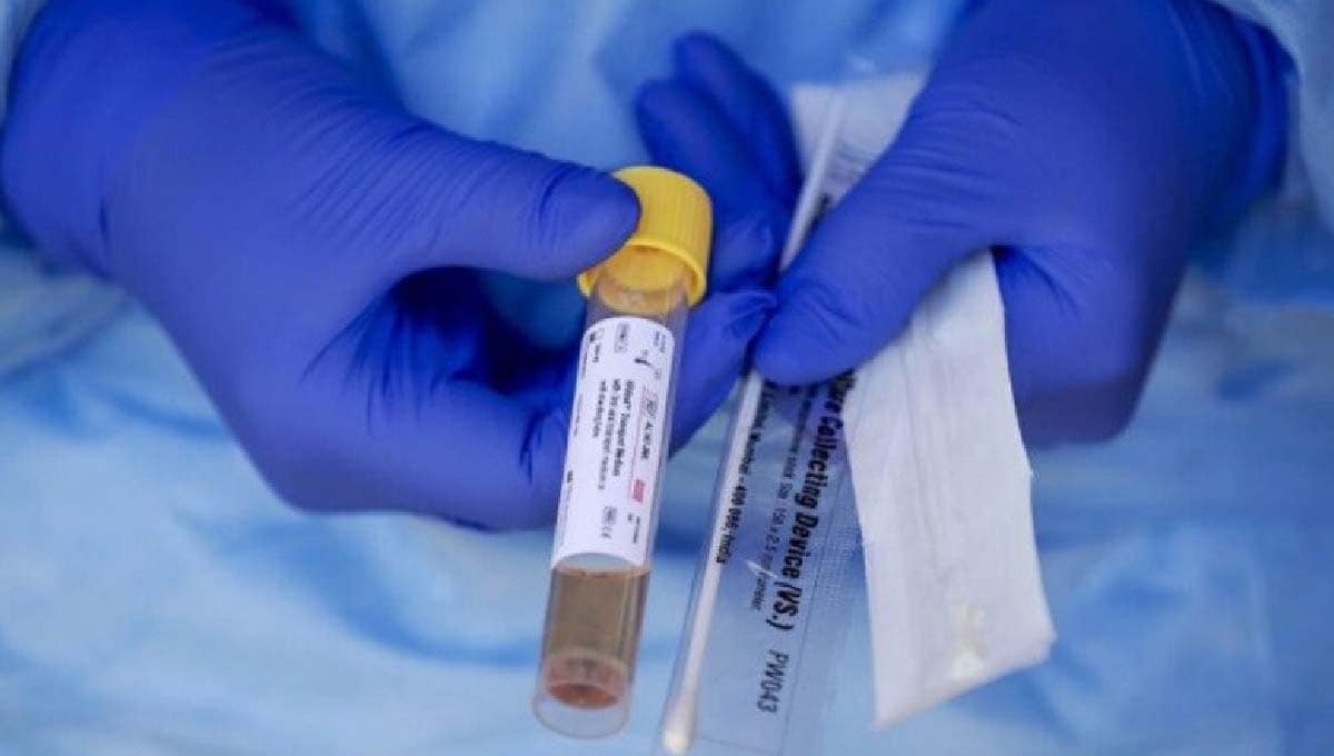 China começa a realizar testes retais para identificar pacientes com Covid-19