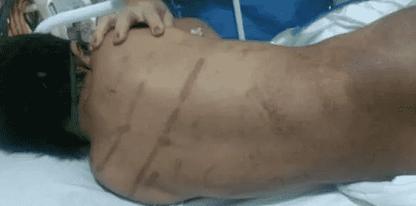 Criança de Corumbá espancada por pais adotivos deixa hospital em Londrina